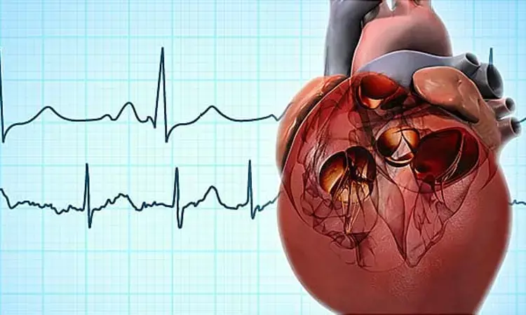 Postoperative atrial fibrillation is as likely to cause stroke as non-surgery AF development: Study