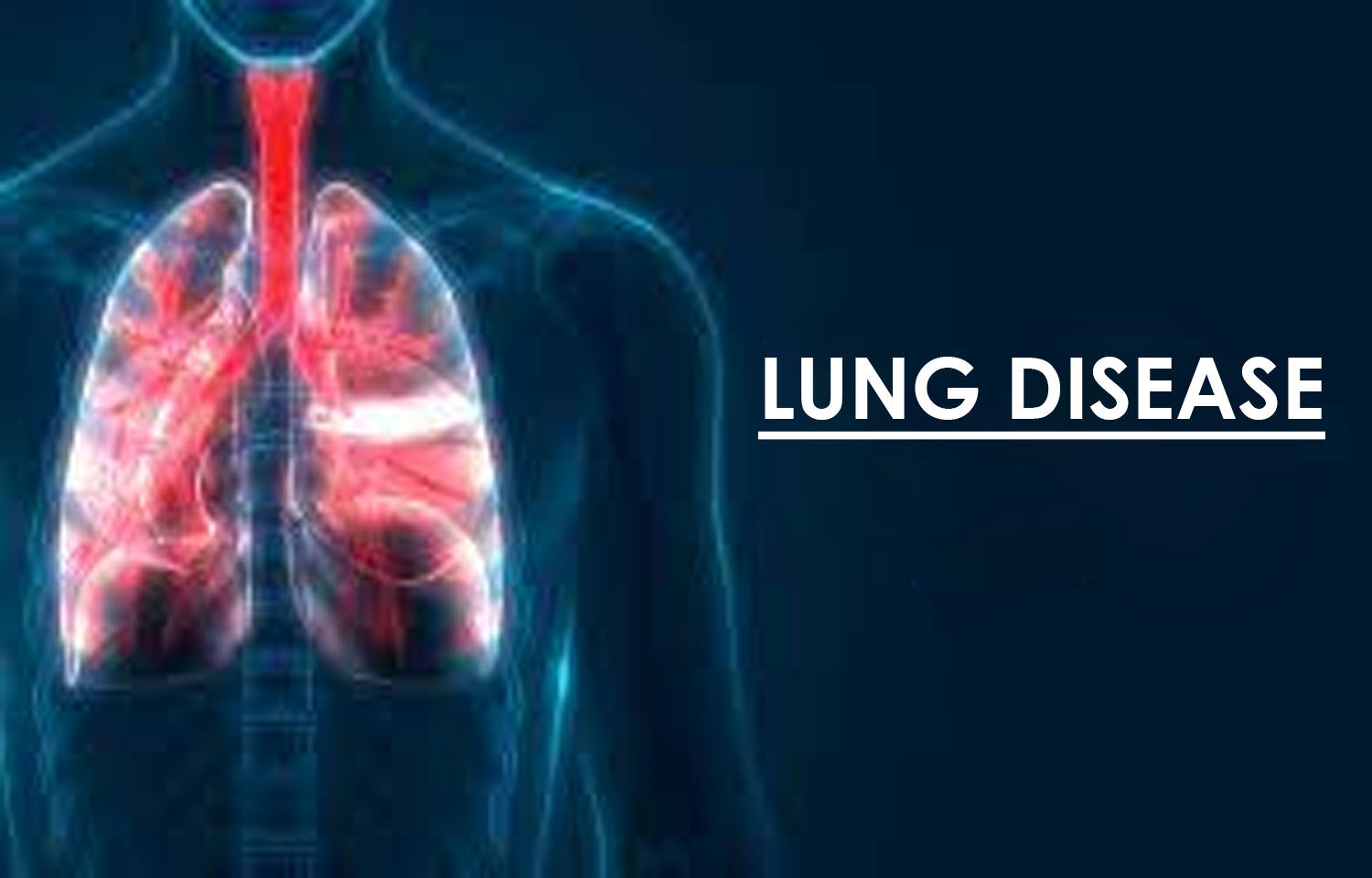 Percutaneous image-guided microwave and cryoablation for lung sarcoma