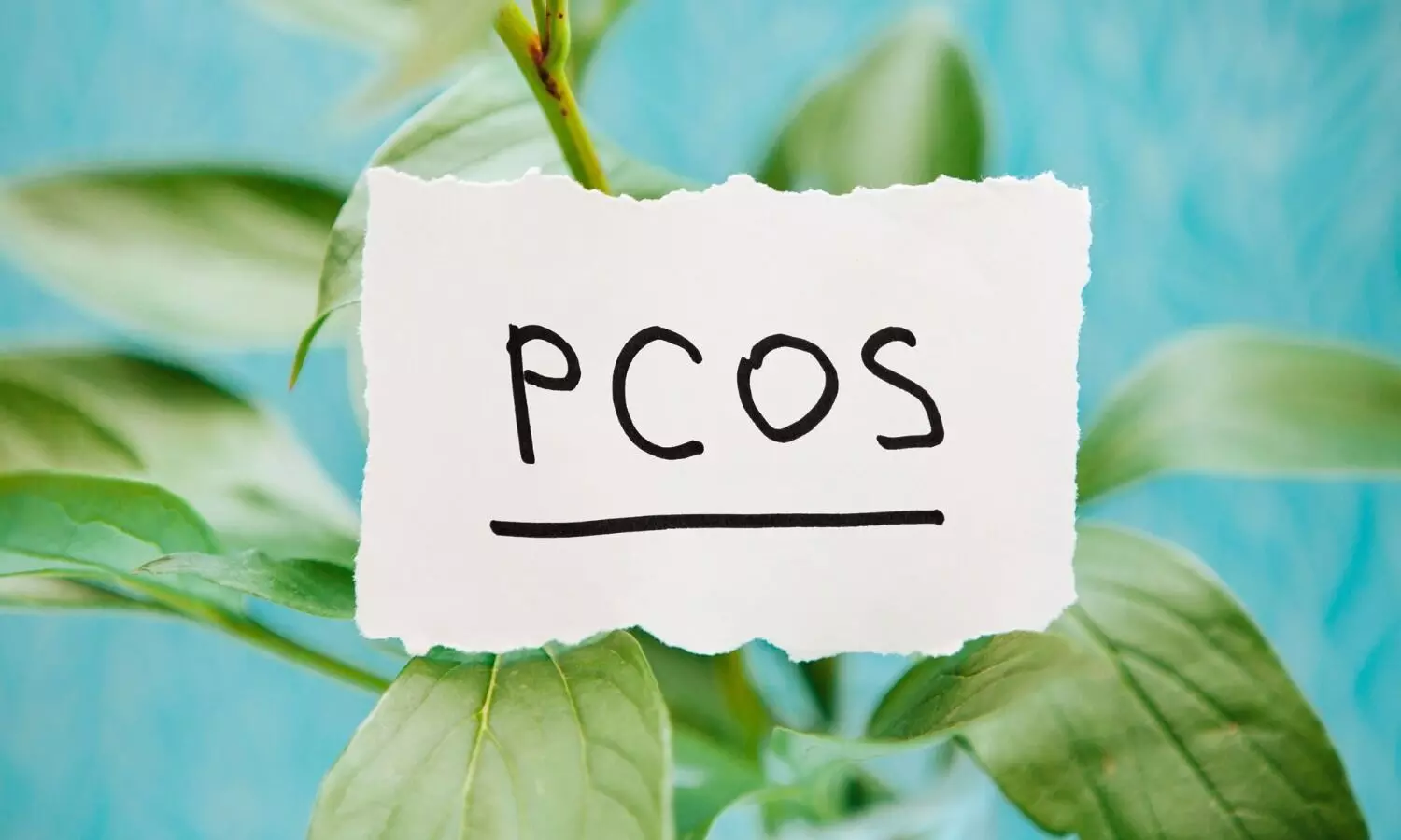 Can oral contraceptives improve Taste function in women with PCOS?