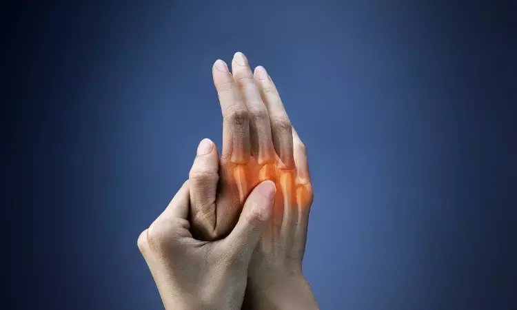 Olokizumab safe and effective for treatment of rheumatoid arthritis: BMJ
