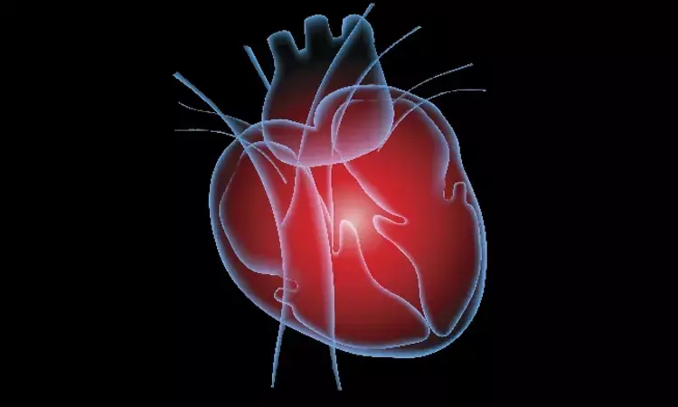 Right Heart Catheterization improves outcomes of cardiogenic shock: Study