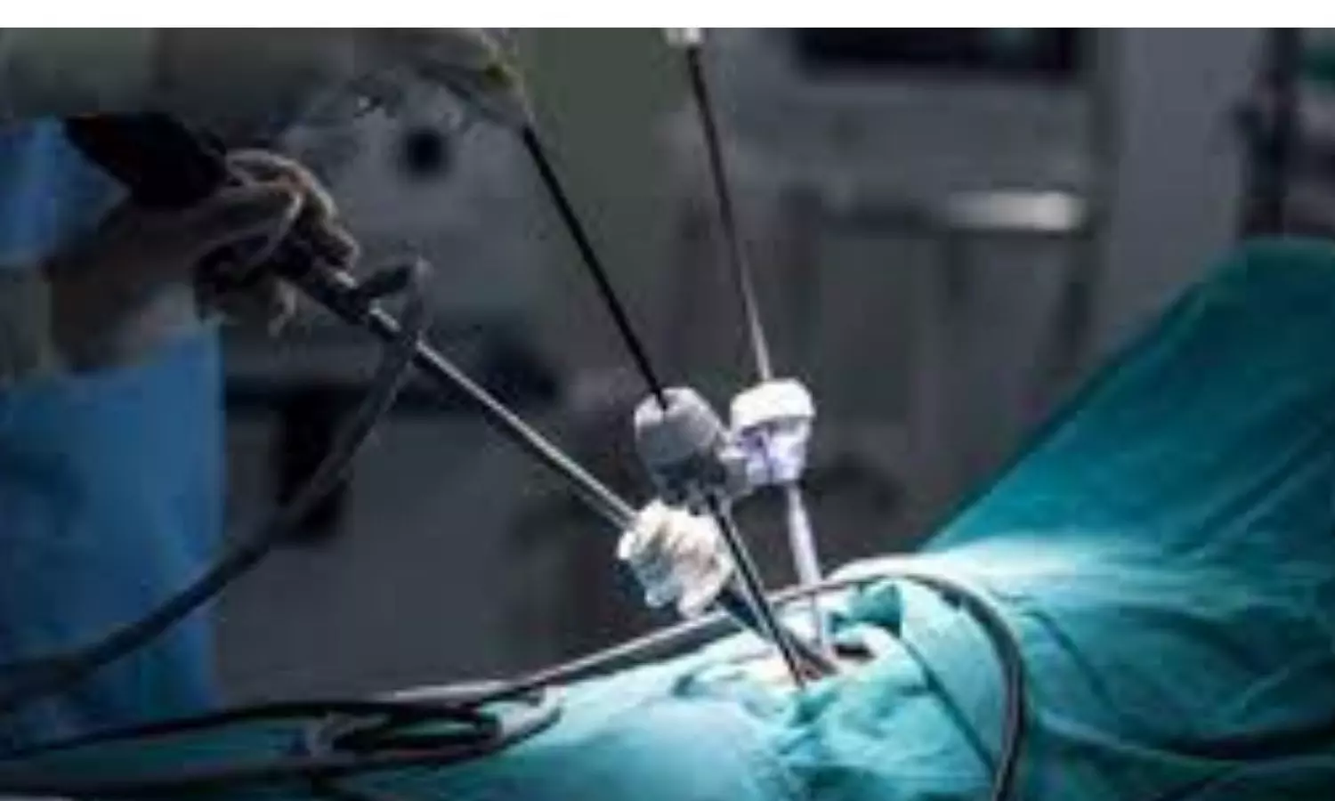 JnK: GMC Doda becomes pioneer in advanced Minimal Access surgery