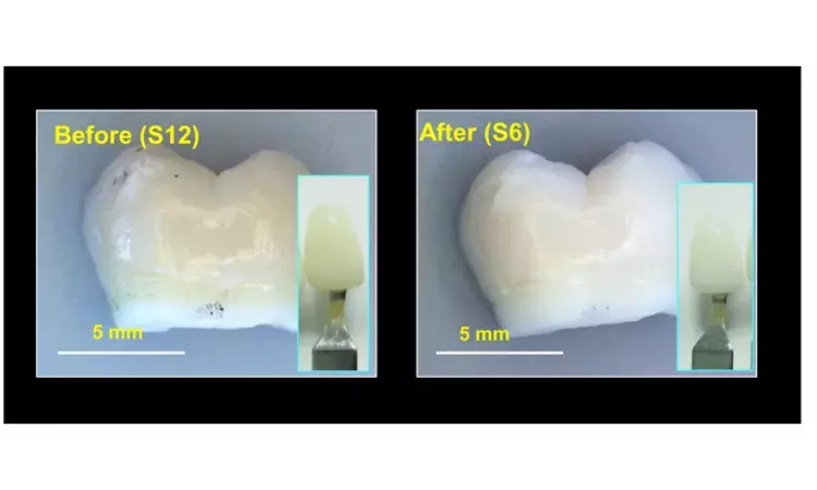 Researchers develop gel that safely whitens teeth when exposed to near infrared light