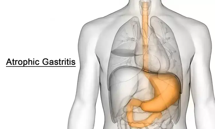 Diagnosis and Management of Atrophic Gastritis: AGA Clinical Practice Update