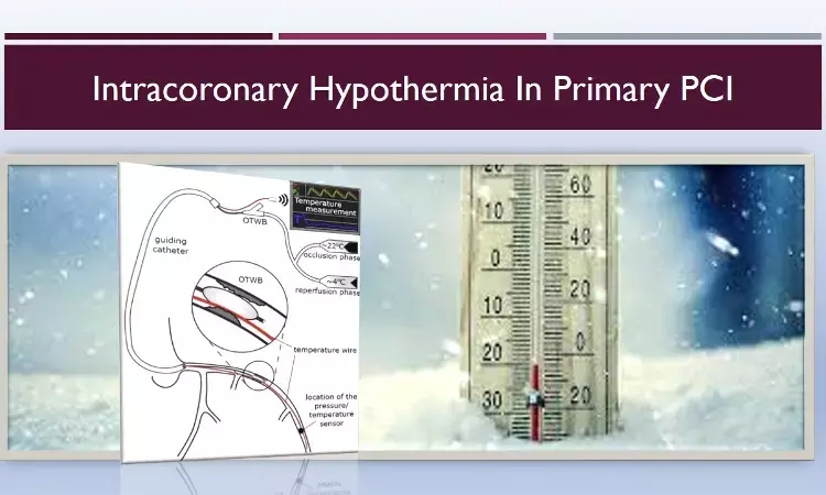 Intracoronary hypothermia safe in primary PCI reveal early results of EURO-ICE trial