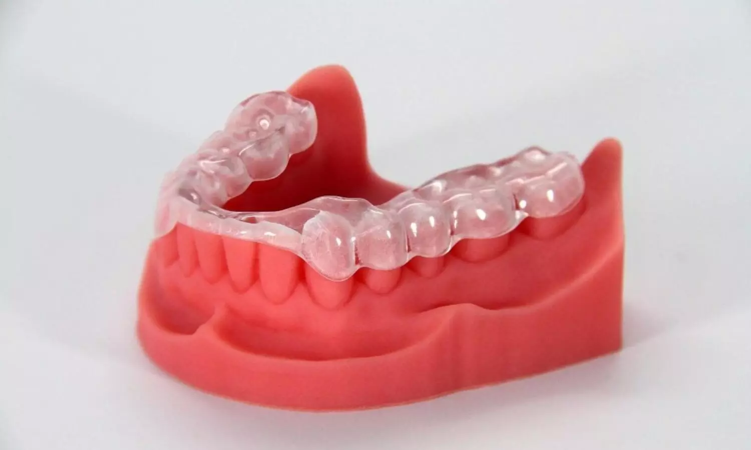 Hybrid resin-based composites useful in printing efficient dental crowns: Study