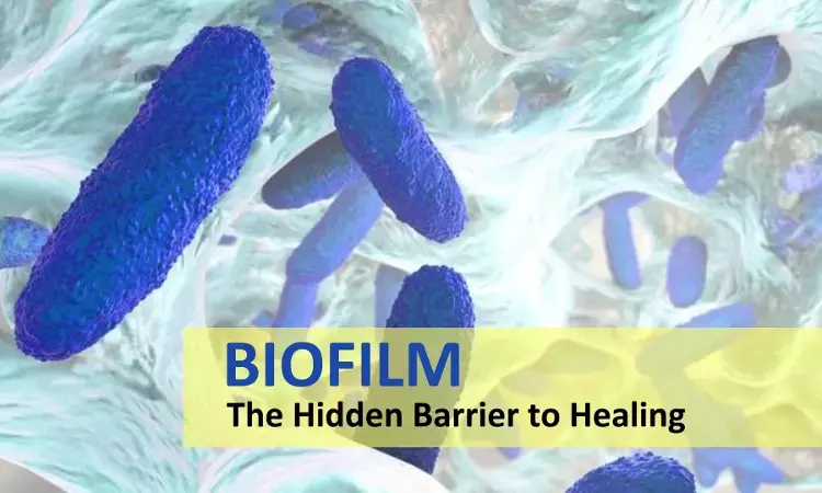 What is Biofilm? & why there is a need to eradicate it?