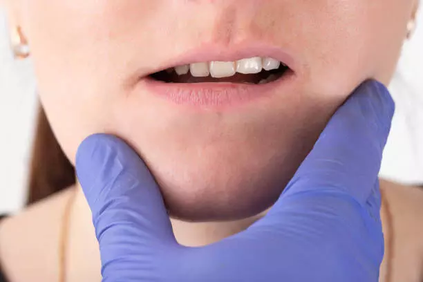 Malocclusion does not impact presence of bruxism nor TMD complaints in adulthood: Study