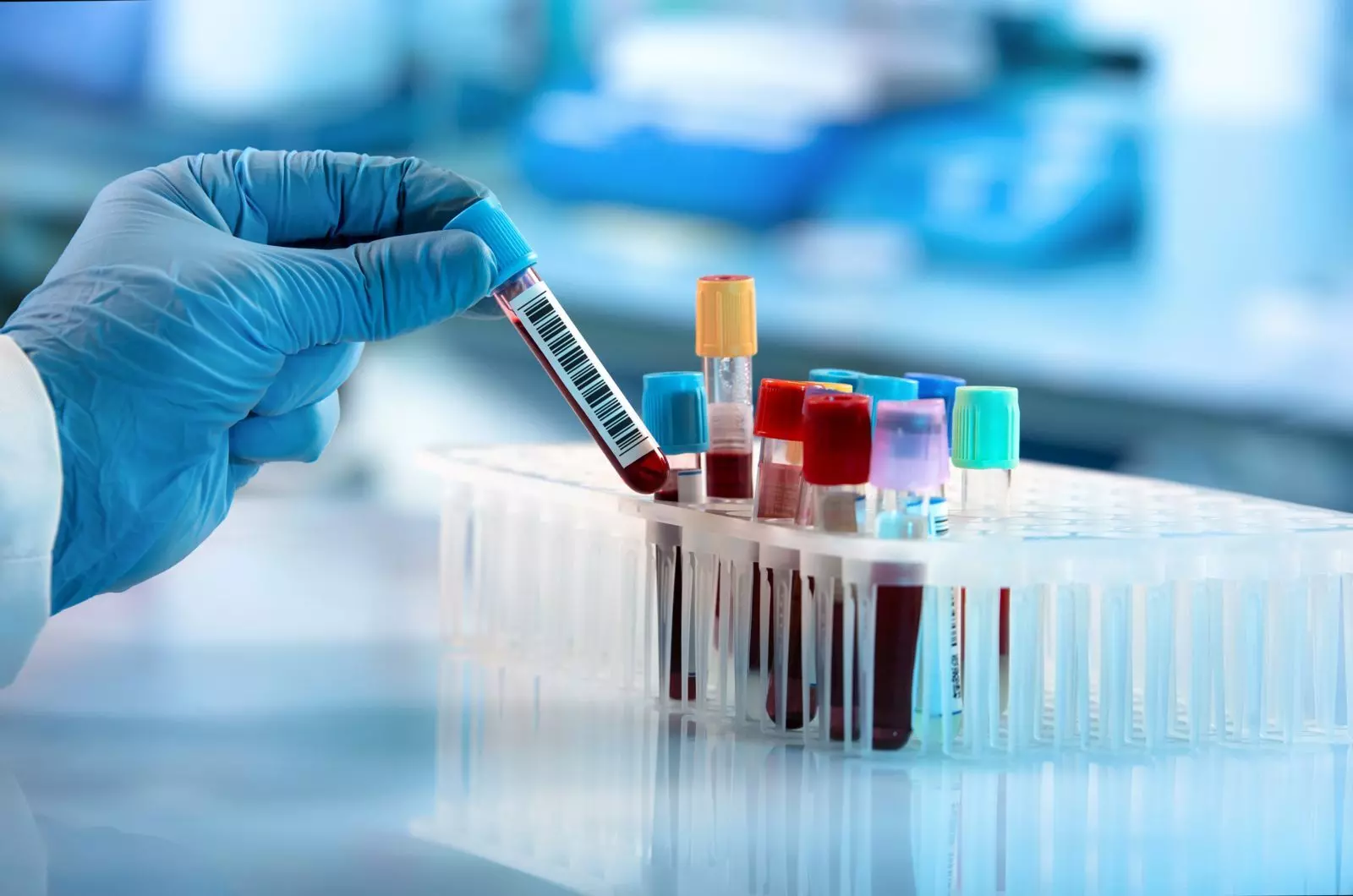 Continual Supply of DNA Test Kits to Forensic Labs is primary Duty of State: MP High Court