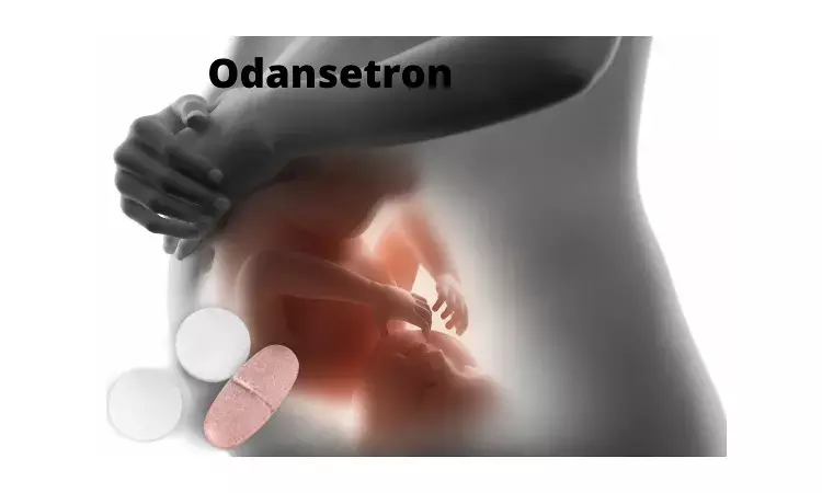 Ondansetron expsoure during pregnancy not associated with adverse fetal outcomes: JAMA