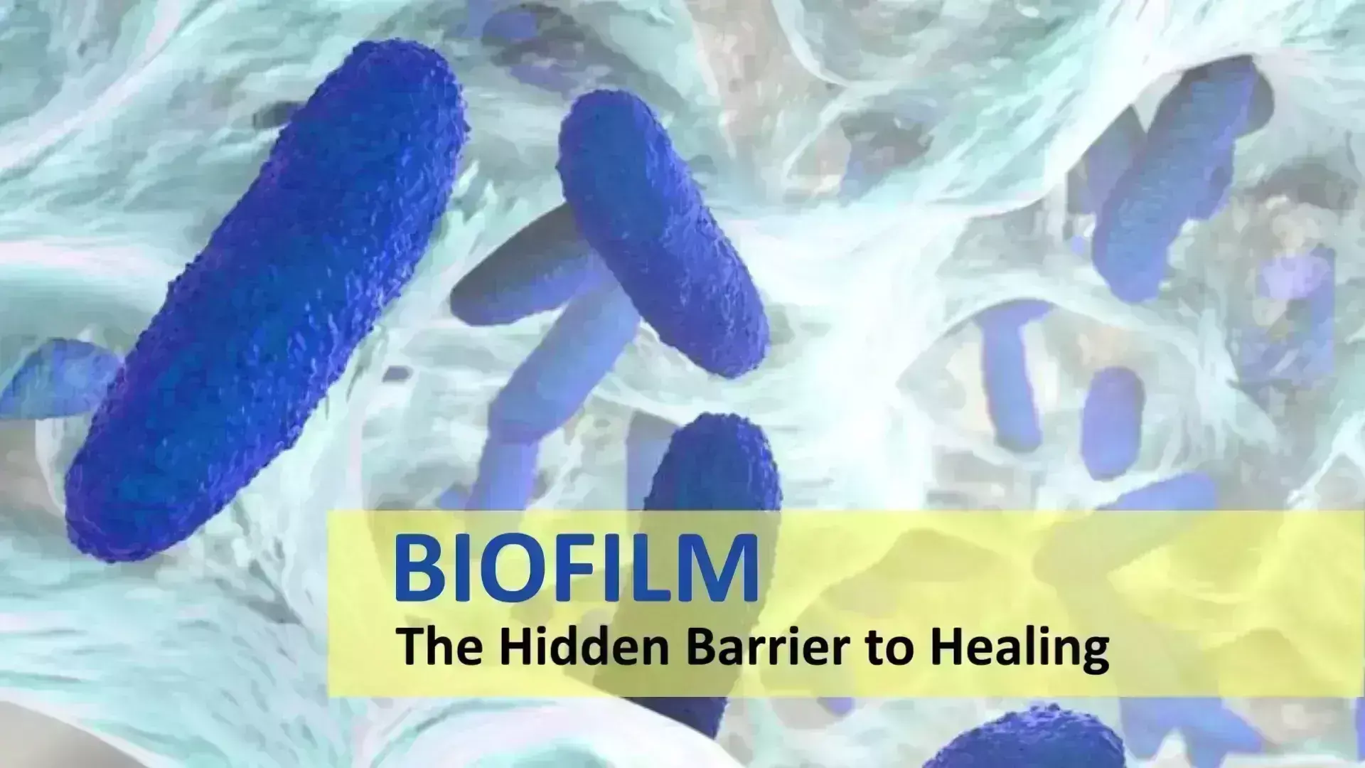 Biofilm- The hidden barrier to healing
