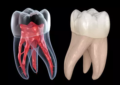 A new approach makes it easier for AI to spot pulp cavities: Study