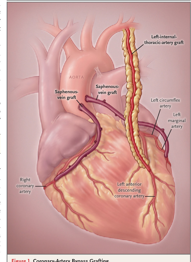 internal thoracic vein