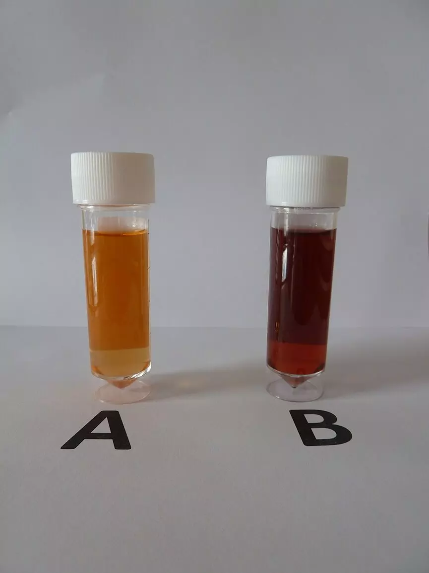 porphyria urine color