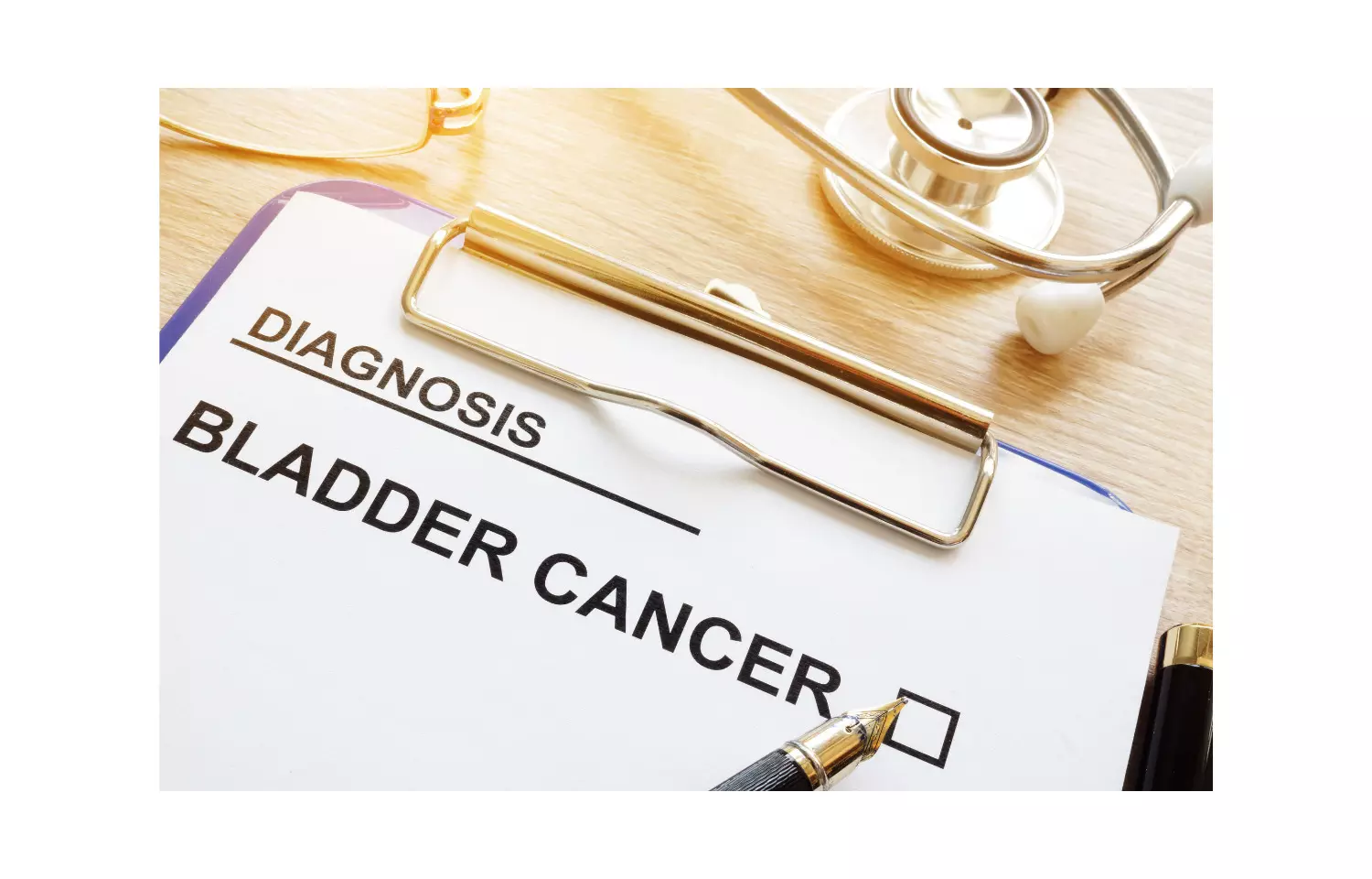 HYAL-1 and survivin suitable urine biomarkers for bladder cancer diagnosis: Study