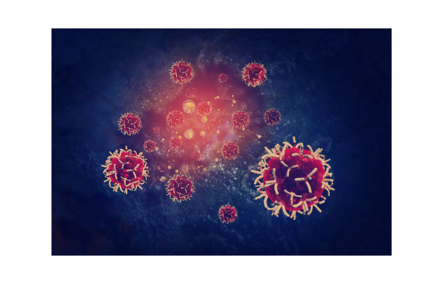 Patients of Myeloproliferative neoplasms are at high risk of infection: Study