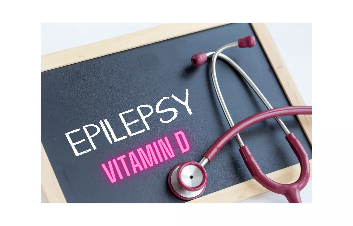 Vitamin D deficiency associated with two third patients of paediatric epilepsy: Study