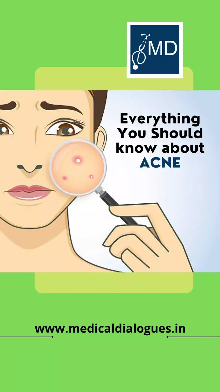 Everything you should know about ACNE