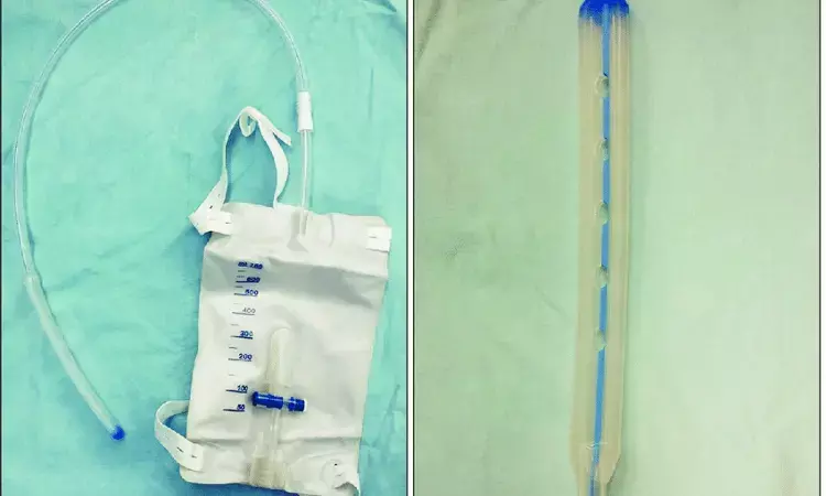Transanal Drainage Tubes do not  prevent anastamotic leakage after Rectal Cancer surgery: JAMA
