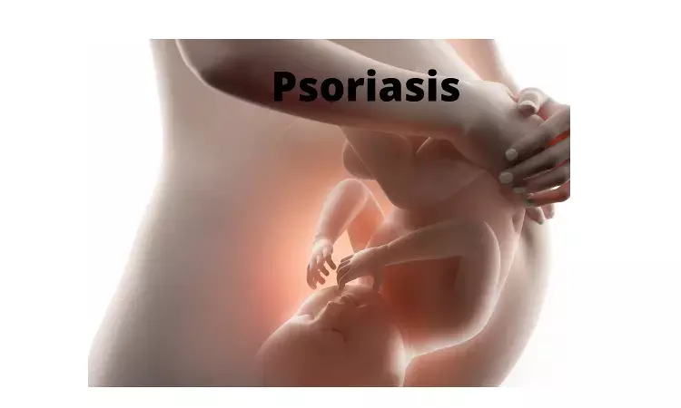 Psoriasis and PsA in pregnancy have adverse maternal events but no neonatal events: Study