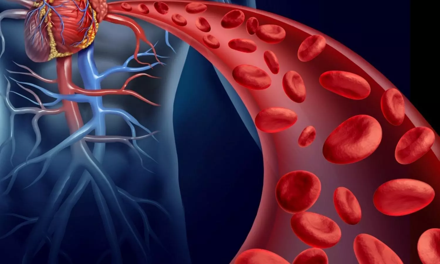 Hydroxyurea improves cardiac abnormalities in young patients with sickle cell anemia: Study