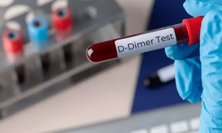 D-Dimer, poor screening test for excluding pulmonary embolism in COVID-19 patients: JAMA