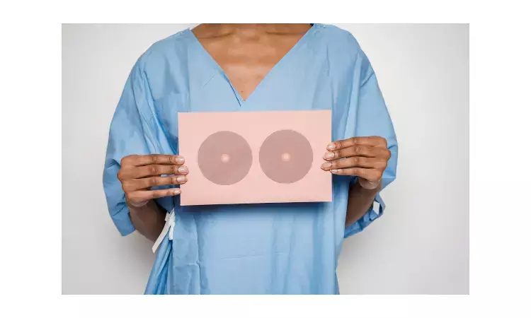 Mastectomy may affect psychosocial health and quality of life in women after surgery: JAMA