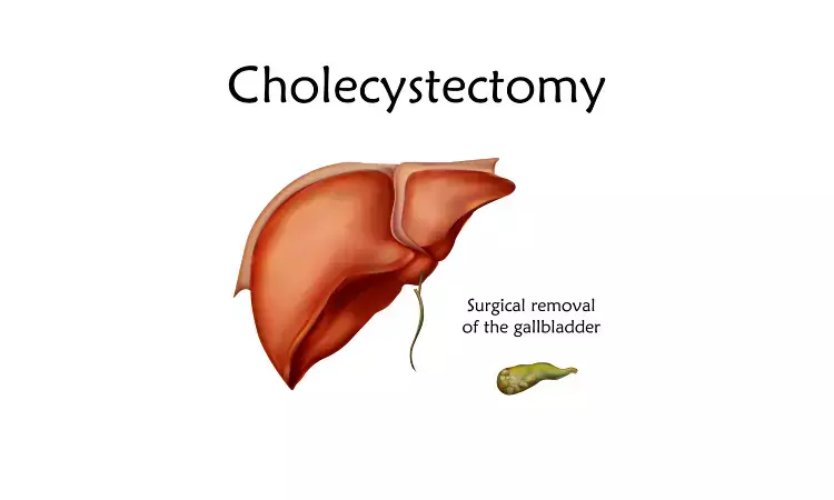 Novel model may decide which patient with gallstone disease will benefit from cholecystectomy: JAMA