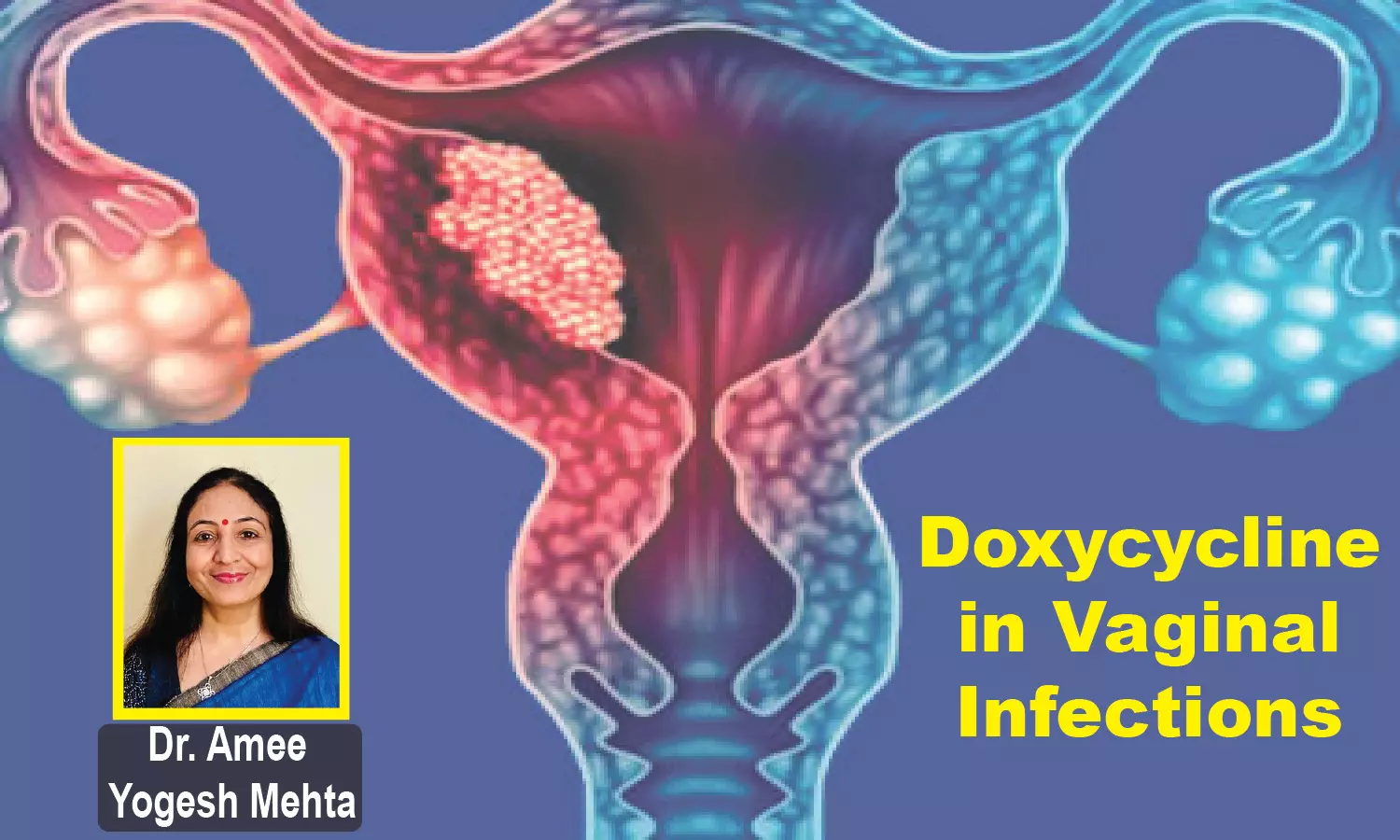 Doxycycline : Consideration as Valuable Agent in Composite Vaginal Infections 