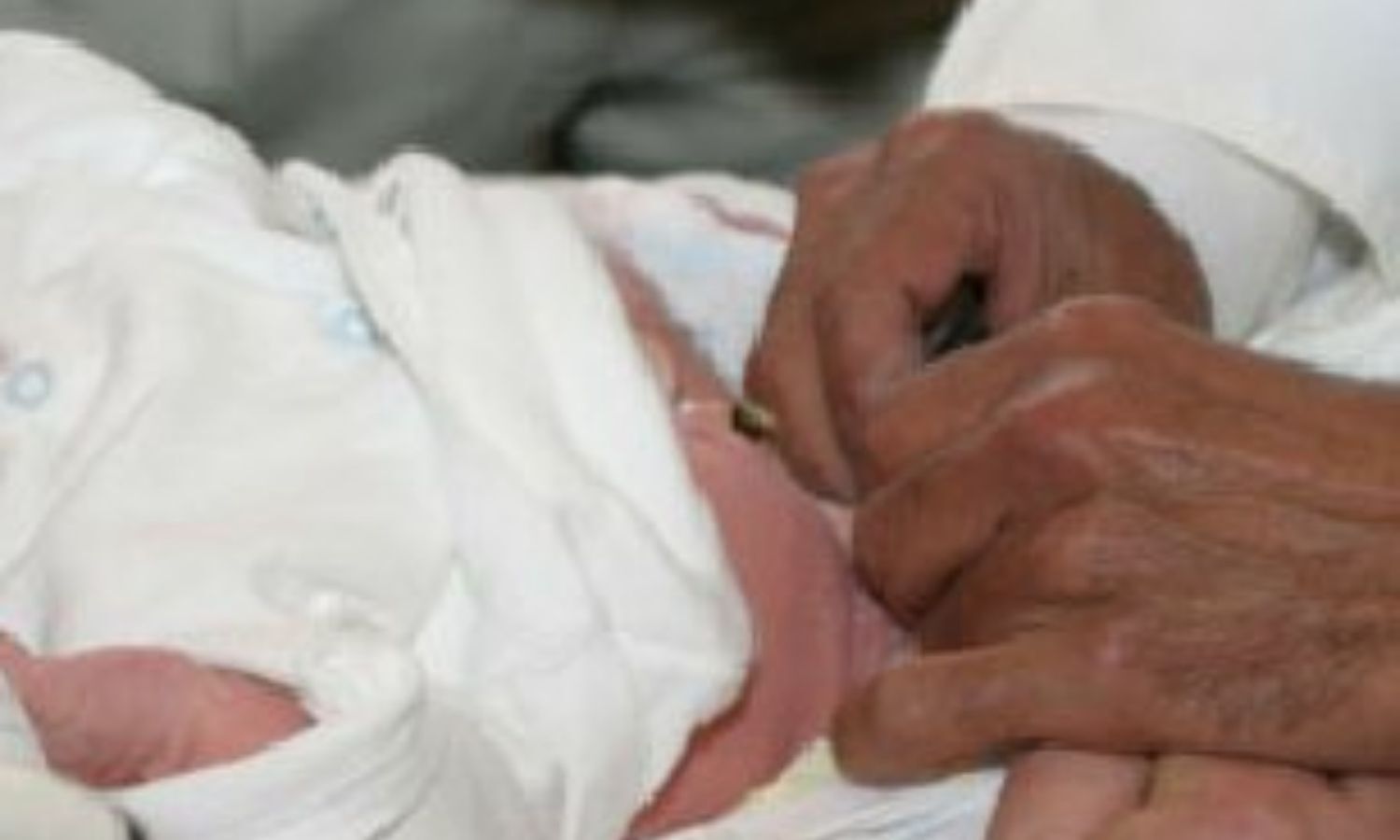 Serious complications, death after neonatal circumcision higher than believ...