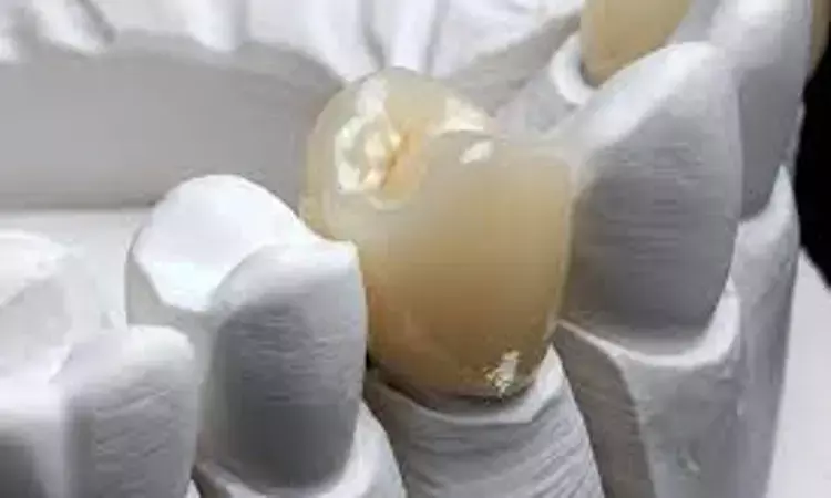Saliva critically Influences  Mechanical Properties of Advanced Composites for dental restorations: Study