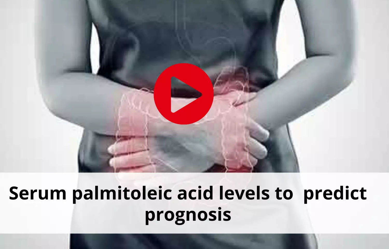 Serum palmitoleic acid levels to  predict prognosis