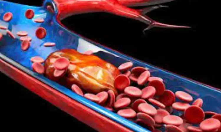Mechanical thrombectomy effective treatment option for stroke in elderly also