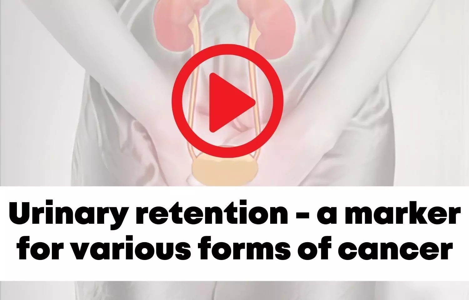 Urinary retention - a marker for various forms of cancer