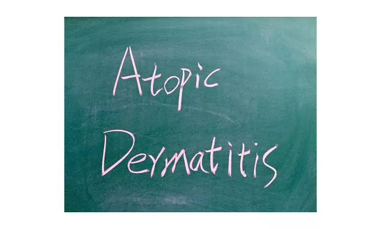 Tralokinumab plus topical corticosteroids effective in severe atopic dermatitis