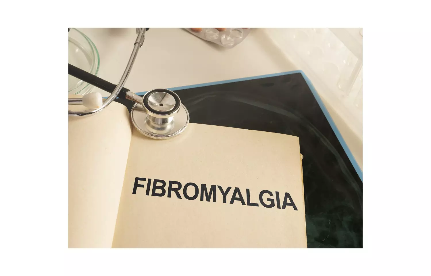 Bedtime Cyclobenzaprine may  improve pain fatigue and sleep in Fibromyalgia