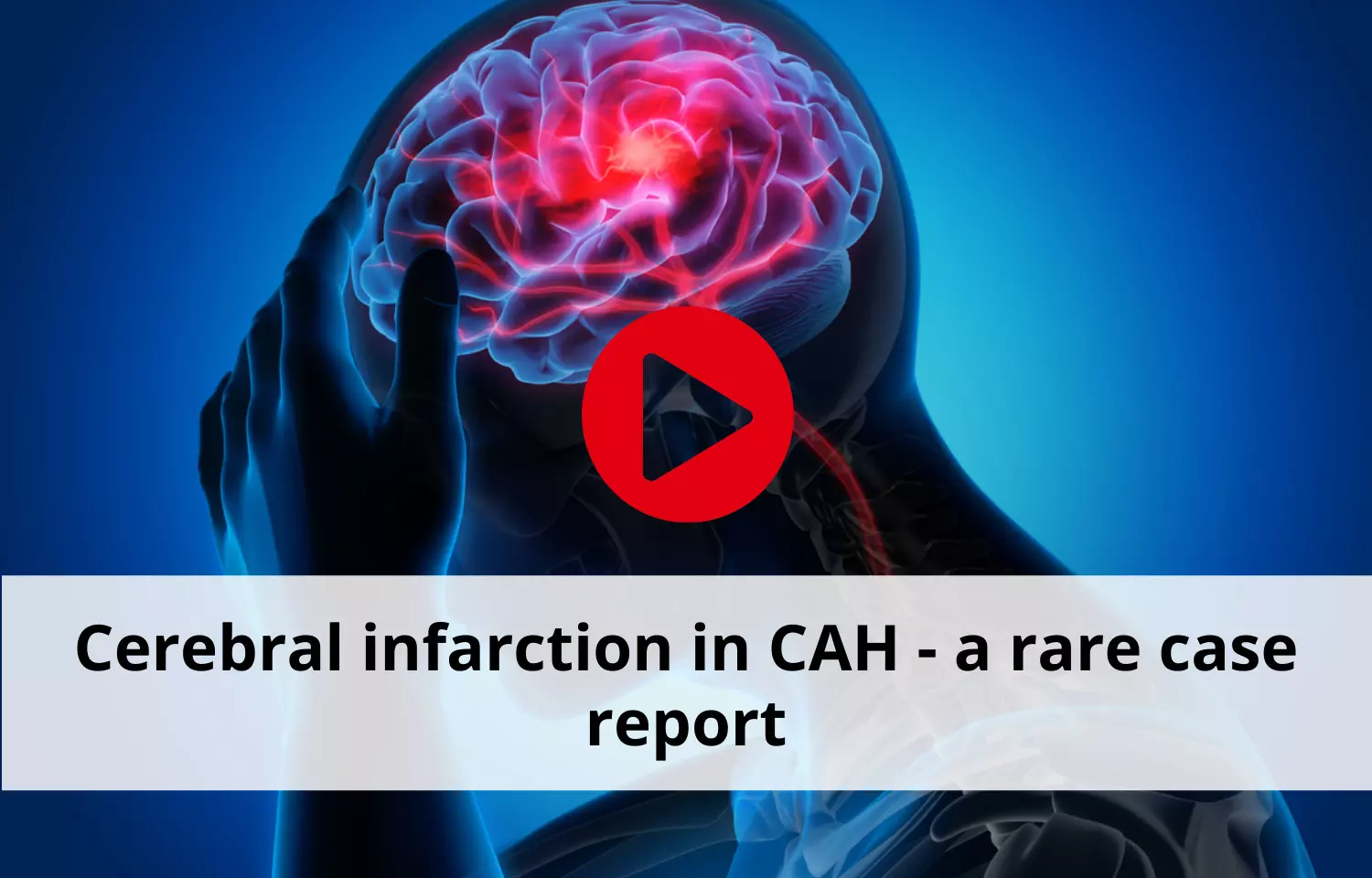 Cerebral infarction in CAH - a rare case report