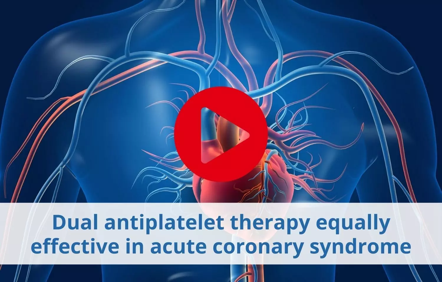Dual antiplatelet therapy equally effective in acute coronary syndrome