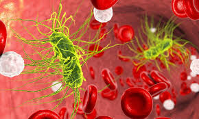 Admission blood sugar may predict prognosis in sepsis patients: Study