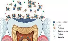 Amalgamation of Chitosan capped nanoparticles into dentine bonding agents may prevent secondary caries