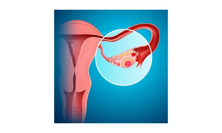 Bilateral oophorectomy before menopause affects cognitive ability: JAMA