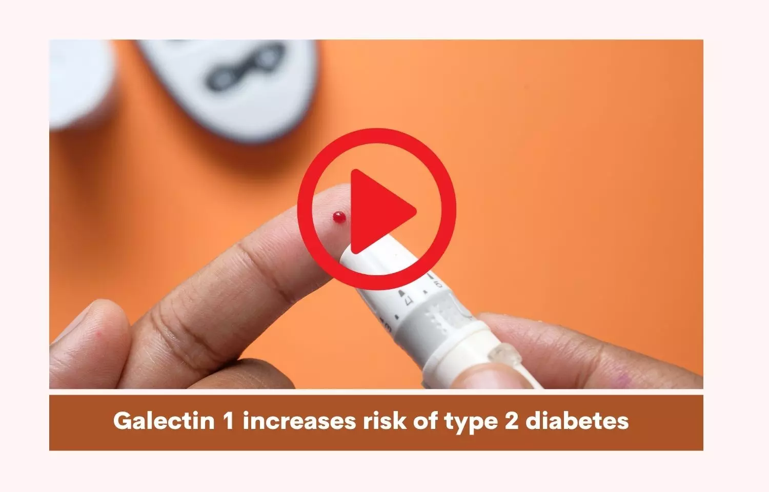 Galectin 1 decreases risk of Nephropathy in Diabetics