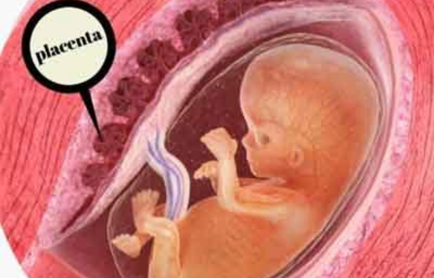 Матка в 11 недель. Плацента эмбриона человека.