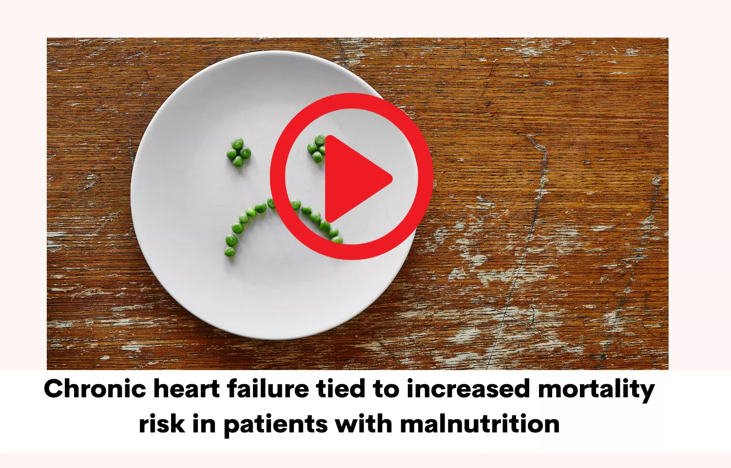 Chronic heart failure tied to increased mortality risk in patients with malnutrition