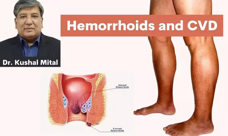 Chorus study revisited- Understanding the common trends of hemorrhoidal disease and chronic venous disease