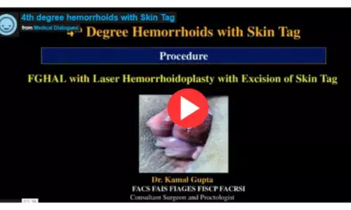 4th degree hemorrhoids with Skin tag