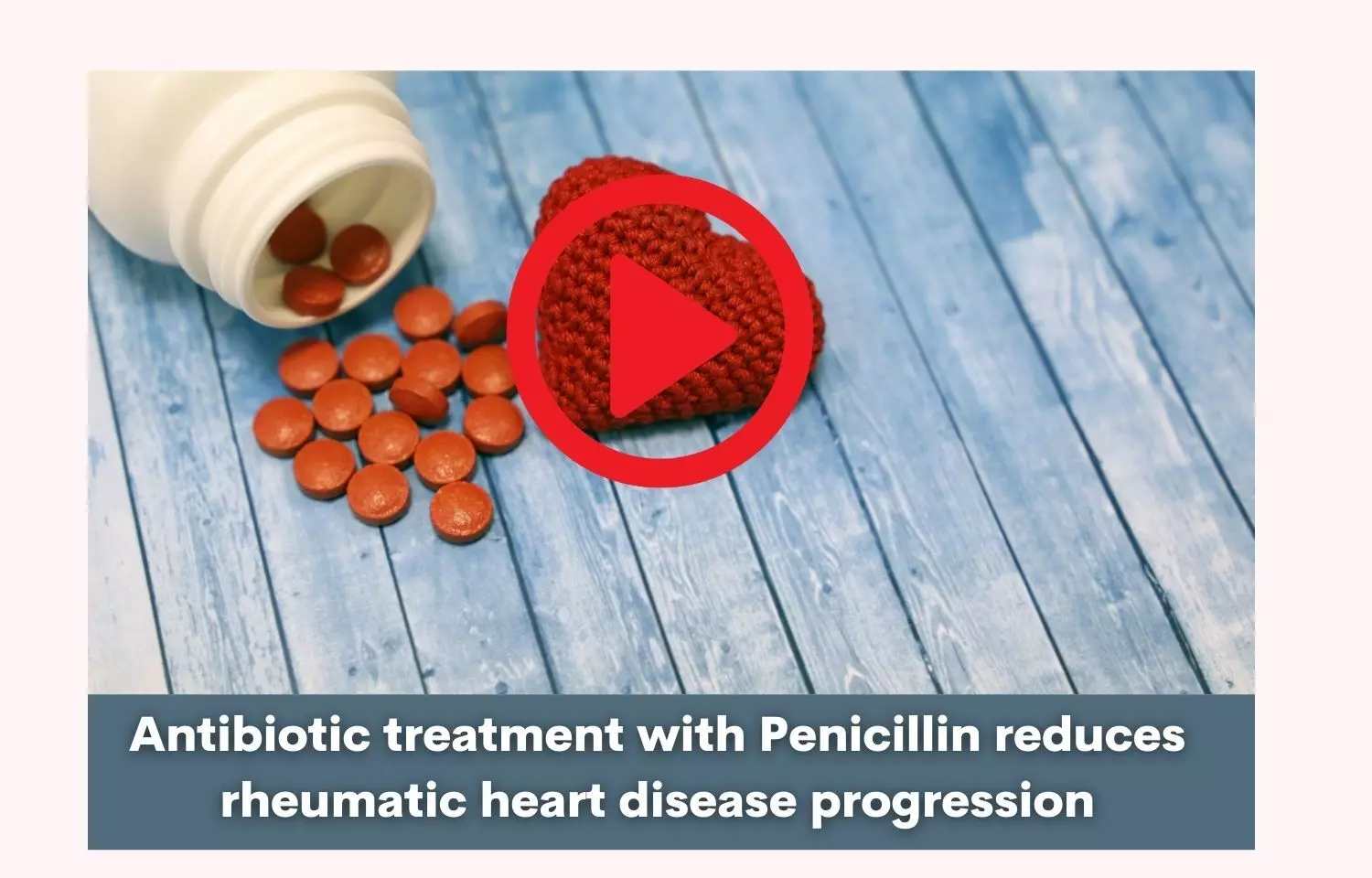 Antibiotic treatment with Penicillin reduces rheumatic heart disease progression