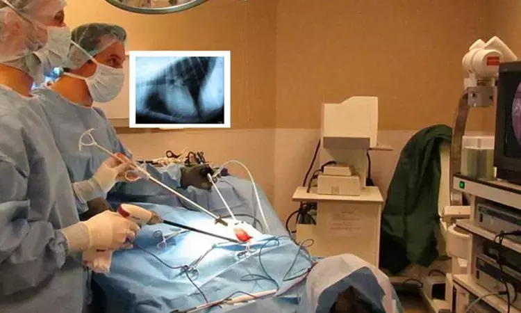 Thoracoscopy safe surgical option for Gross type C esophageal atresia: Study