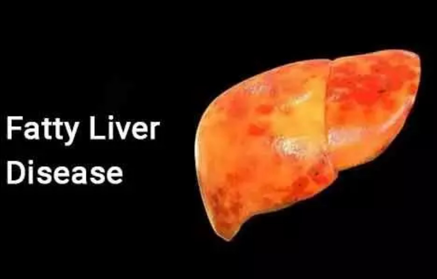 Can Liver Inflammation Go Away