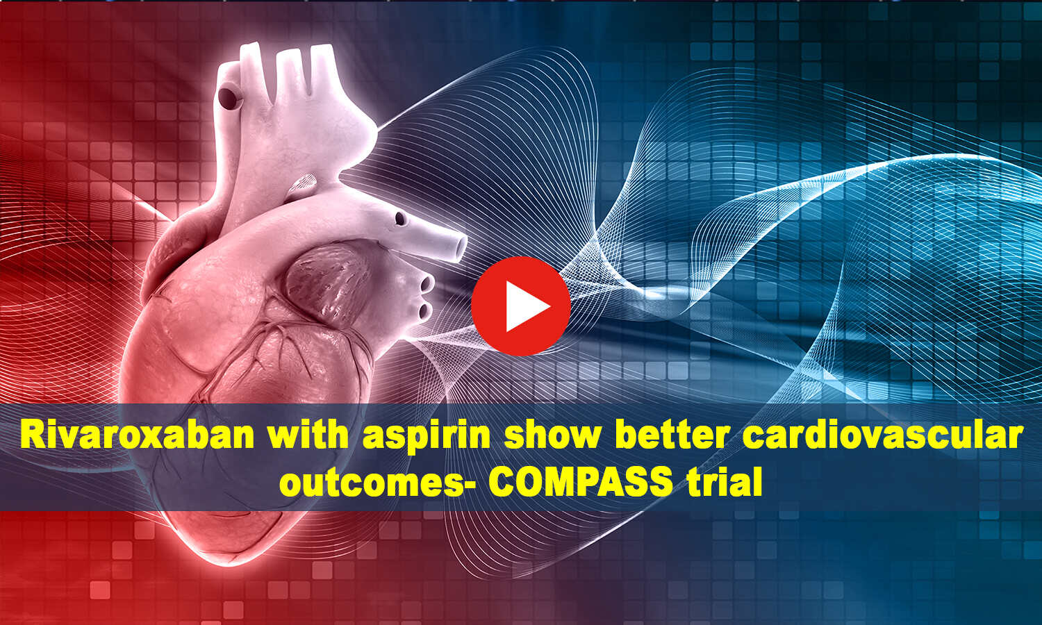 Combination Of Rivaroxaban And Aspirin Improves Cv Outcomes Compass Trial